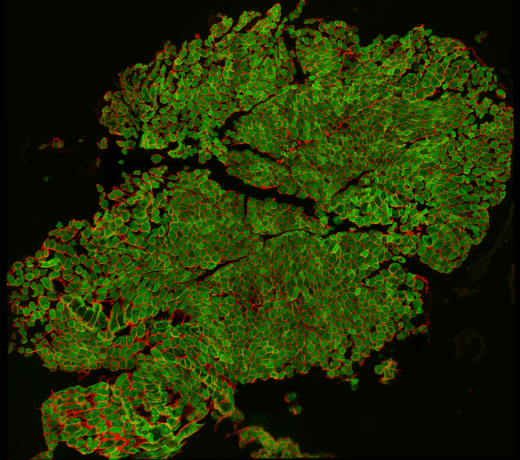 before the annotation of skeletal muscle cells